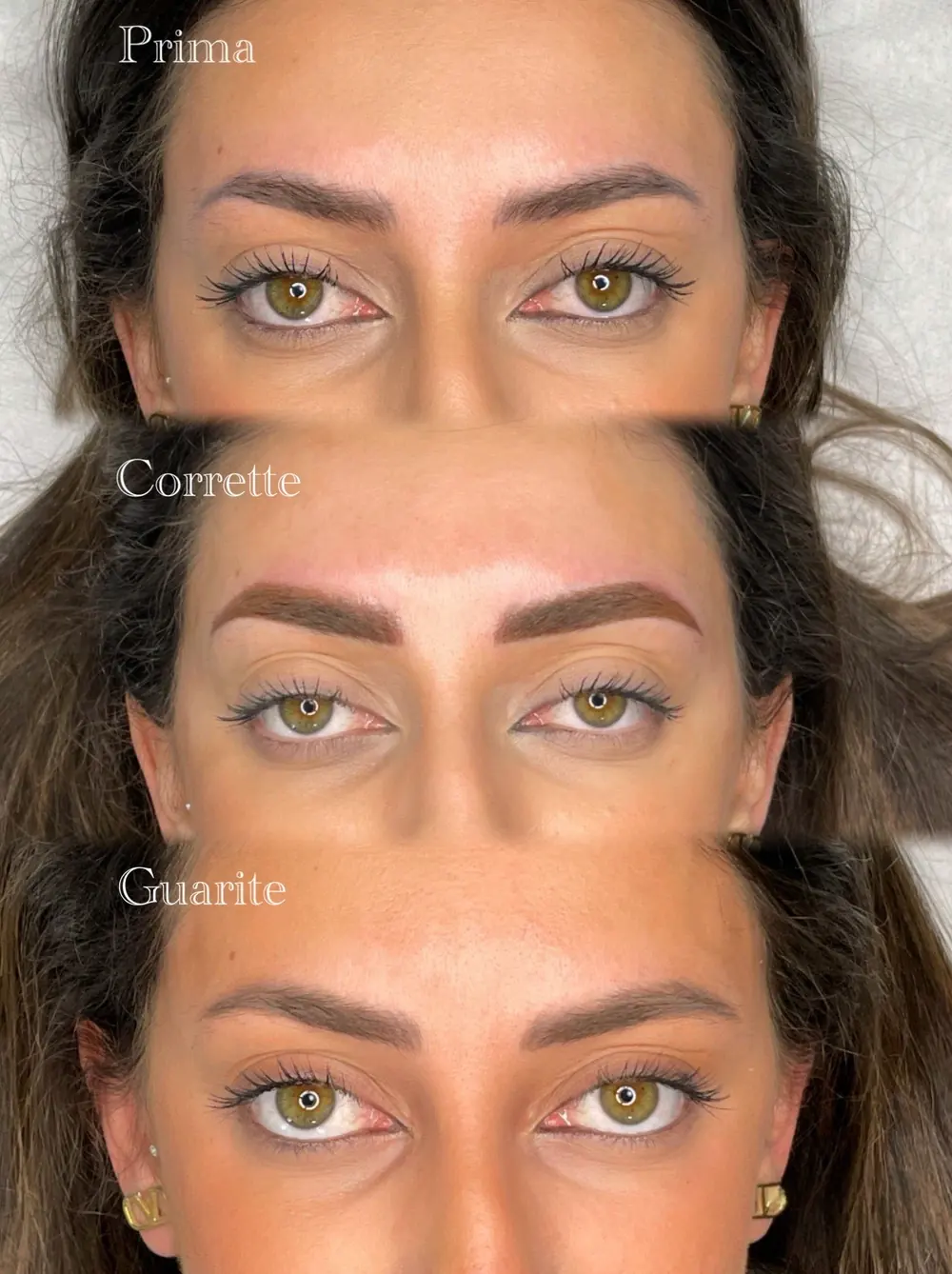 Lo stesso sguardo prima, appena corretto e a guarigione avvenuta