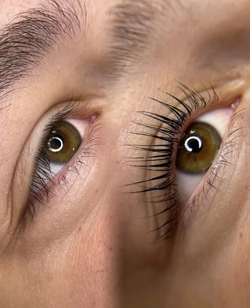 Occhio dopo la laminazione, in luce naturale